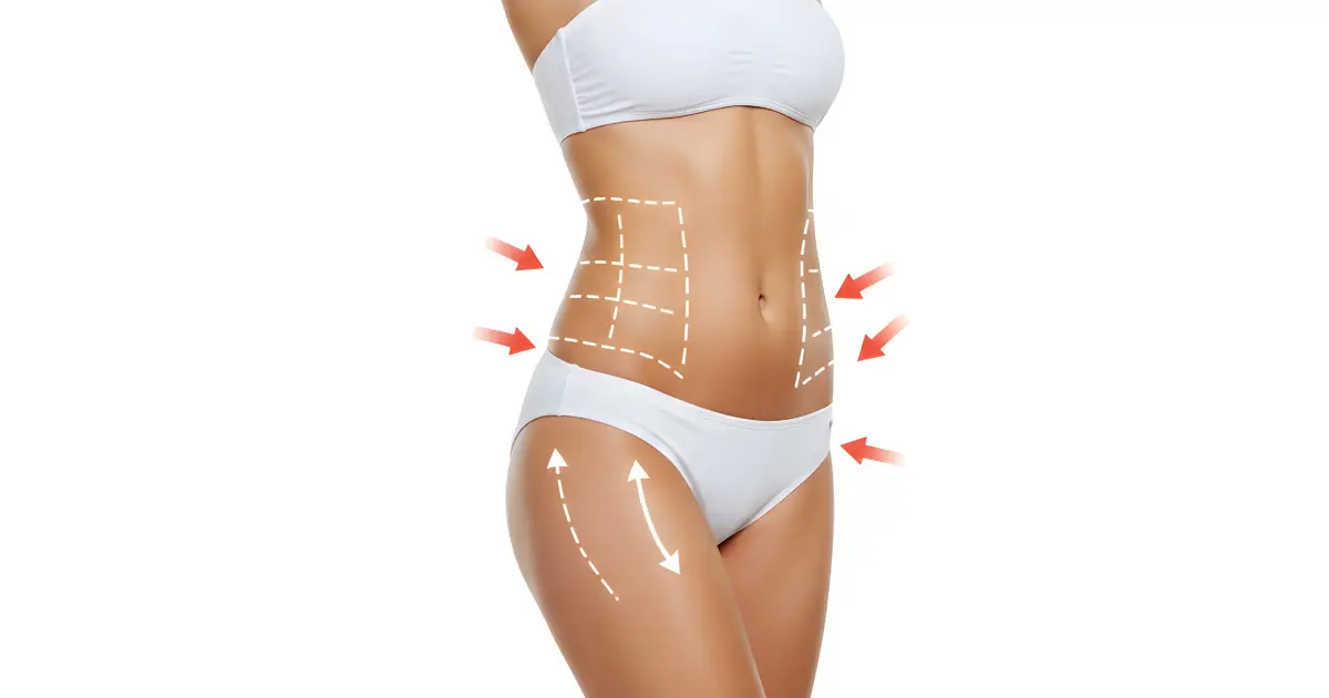 Woman showing body contouring results after liposuction treatment Salisbury, MD with highlighted waist and abdomen shaping.
